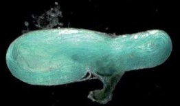 巨大精子在线观看